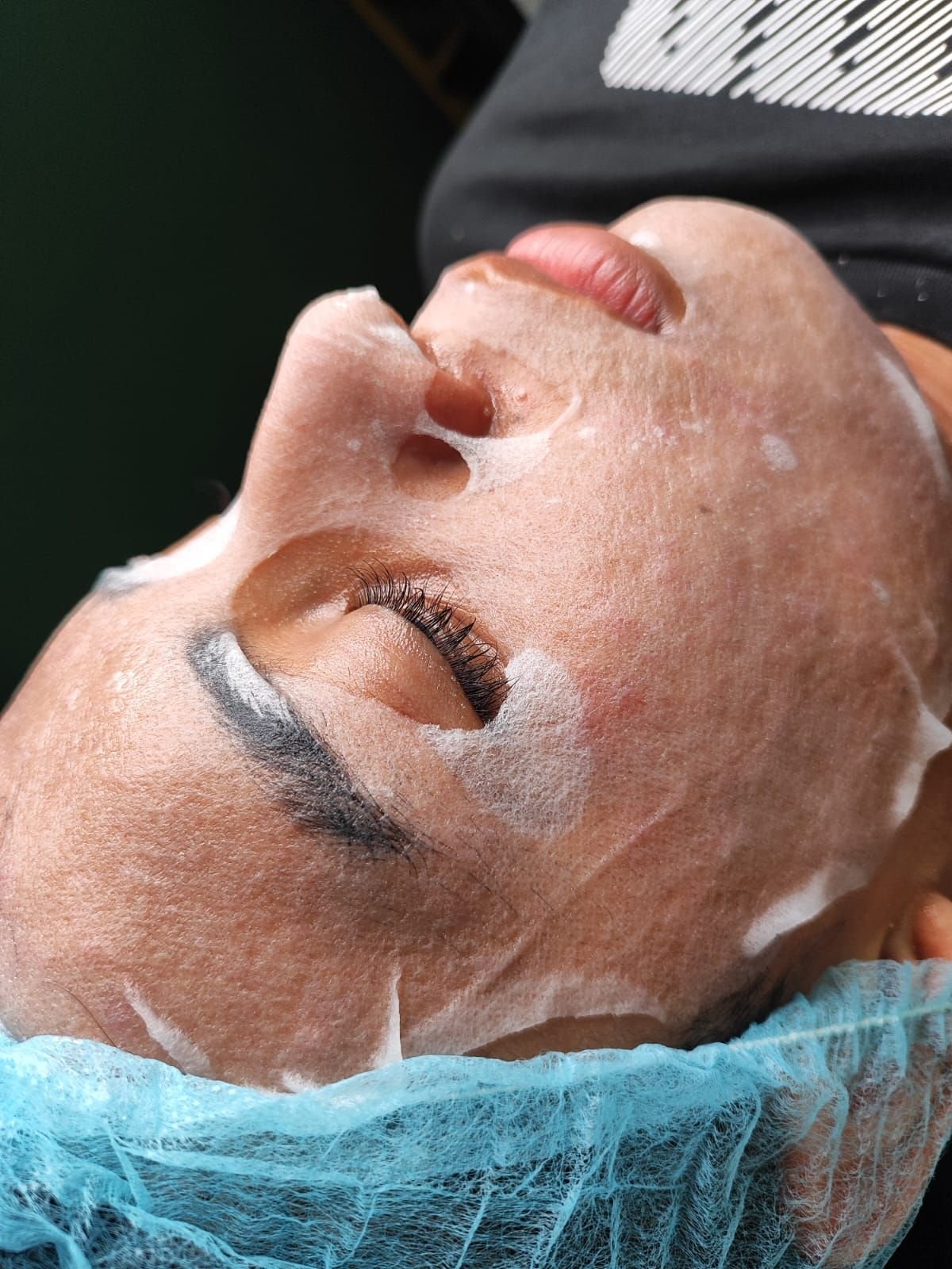 Tratamientos Faciales — foto 2