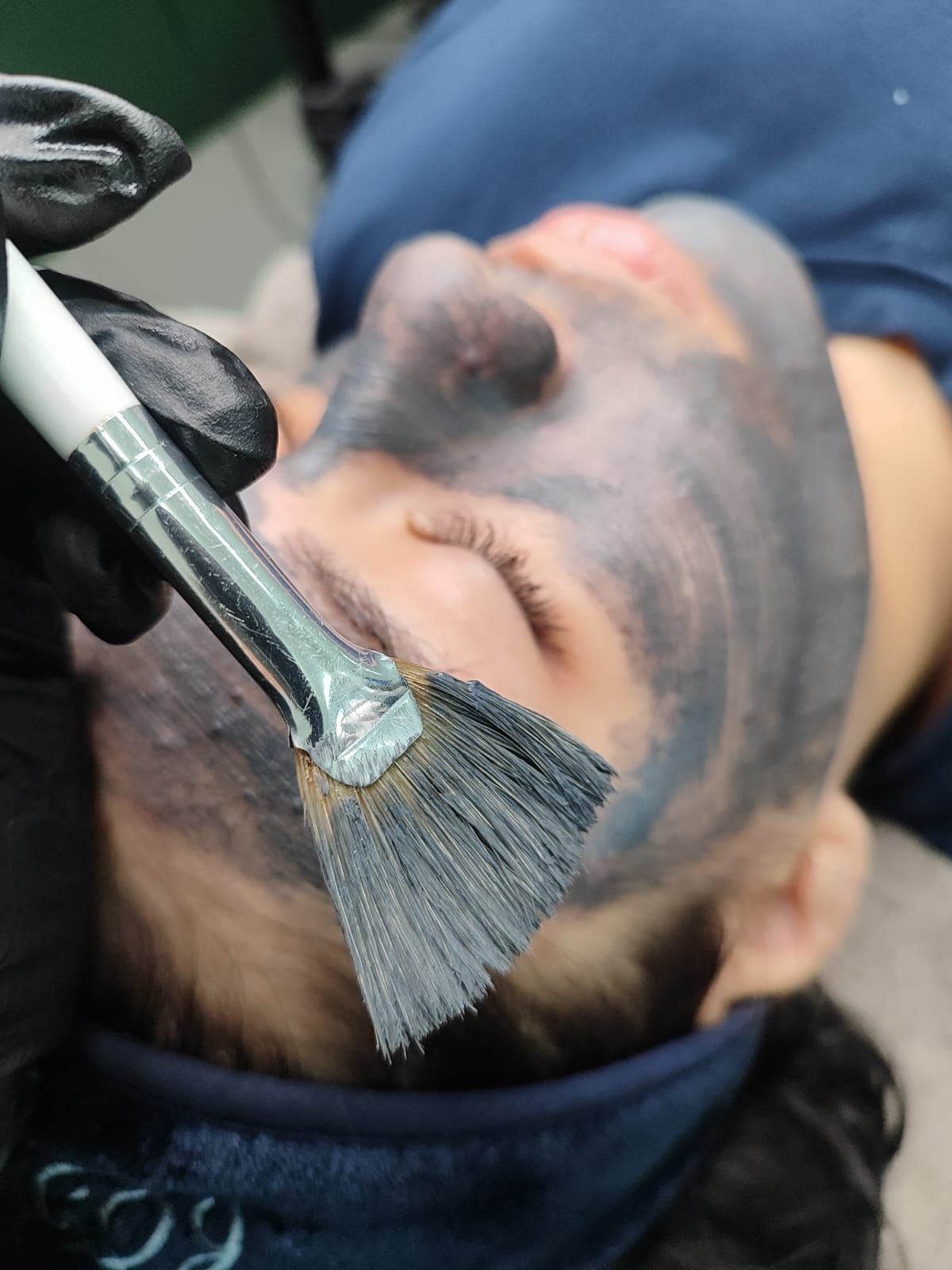 Tratamientos Faciales — foto 4